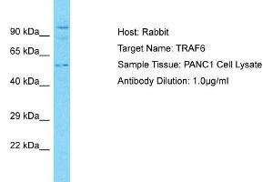 Host: Rabbit Target Name: TRAF6 Sample Type: PANC1 Whole Cell lysates Antibody Dilution: 3. (TRAF6 Antikörper  (C-Term))