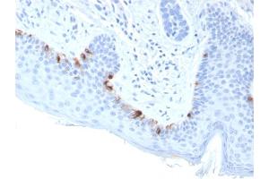 Formalin-fixed, paraffin-embedded human Skin stained with TYRP1-Monospecific Mouse Monoclonal Antibody (TYRP1/3283). (Tyrosinase-Related Protein 1 Antikörper  (AA 257-377))