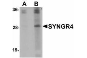 Image no. 1 for anti-Synaptogyrin 4 (SYNGR4) (N-Term) antibody (ABIN478102) (SYNGR4 Antikörper  (N-Term))