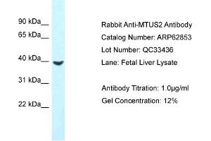 Western Blotting (WB) image for anti-Microtubule-associated Tumor Suppressor Candidate 2 (MTUS2) (C-Term) antibody (ABIN2789268) (CAZIP Antikörper  (C-Term))