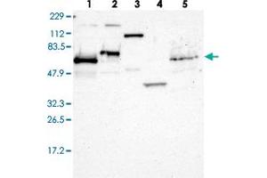 Western blot analysis of Lane 1: RT-4, Lane 2: U-251 MG, Lane 3: Human Plasma, Lane 4: Liver, Lane 5: Tonsil with ETV3 polyclonal antibody  at 1:250-1:500 dilution. (ETV3 Antikörper)