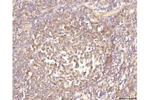 IHC analysis of EIF4B using anti-EIF4B antibody (ABIN7599496). (EIF4B Antikörper  (AA 1-611))