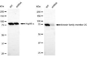 Western blotting analysis using kinesin family member 2C antibody (ABIN7799206). (Rekombinanter KIF2C Antikörper)