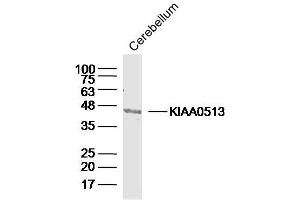 Mouse cerebellum lysates probed with KIAA0513 Polyclonal Antibody, Unconjugated  at 1:300 dilution and 4˚C overnight incubation. (KIAA0513 Antikörper  (AA 21-100))