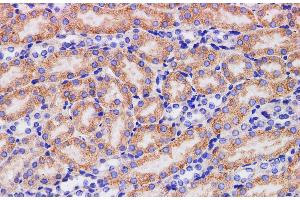 Immunohistochemistry of paraffin-embedded Mouse kidney using HPGD Polyclonal Antibody at dilution of 1:200 (HPGD Antikörper)