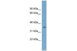 WB Suggested Anti-SLC39A2 Antibody Titration:  0. (ZIP2 Antikörper  (N-Term))