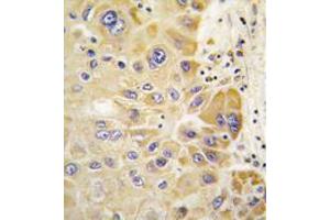 Image no. 1 for anti-Aldehyde Dehydrogenase 2 Family (Mitochondrial) (ALDH2) (AA 325-355) antibody (ABIN356918)
