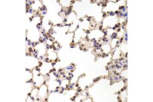 Immunohistochemistry of paraffin-embedded Mouse lung using ALOX15B antibody at dilution of 1:100 (x400 lens). (ALOX15B Antikörper)