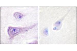Immunohistochemistry analysis of paraffin-embedded human brain, using WASP (Phospho-Tyr290) Antibody. (WASP Antikörper  (pTyr290))