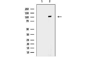 anti-Oculocerebrorenal Syndrome of Lowe (OCRL) (C-Term) antibody