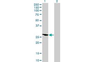 Western Blot analysis of HOXB9 expression in transfected 293T cell line by HOXB9 MaxPab polyclonal antibody. (HOXB9 Antikörper  (AA 1-250))
