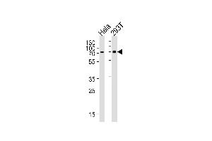 Western blot analysis of lysates from Hela, 293T cell line (from left to right), using SNX1 Antibody at 1:1000 at each lane. (Sorting Nexin 1 Antikörper  (C-Term))