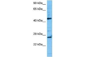 Host:  Mouse  Target Name:  TCF7  Sample Tissue:  Mouse Testis  Antibody Dilution:  1ug/ml (TCF7 Antikörper  (N-Term))