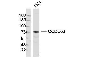 TM4 lysates probed with CCDC62 Polyclonal Antibody, Unconjugated  at 1:300 dilution and 4˚C overnight incubation. (CCDC62 Antikörper  (AA 1-100))