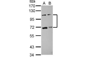WB Image Sample (30 ug of whole cell lysate) A: HCT116 B: MCF-7 7. (ADAMTS5 Antikörper  (C-Term))