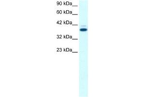 WB Suggested Anti-GABPB2 Antibody Titration:  0. (GABPB2 Antikörper  (C-Term))
