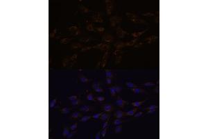 Immunofluorescence analysis of C6 cells using RGS4 antibody (ABIN7269898) at dilution of 1:100. (RGS4 Antikörper  (AA 1-100))