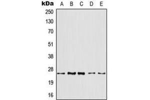 Western blot analysis of ARF4 expression in HeLa (A), HepG2 (B), mouse liver (C), mouse kidney (D), rat kidney (E) whole cell lysates. (ARF4 Antikörper  (Center))