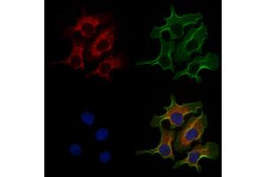 ABIN6258659 and ABIN6274961 staining Hela cells by IF/ICC. (CA5A Antikörper  (Internal Region))