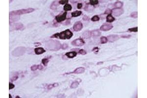 Immunohistochemical staining of Trpv2 in rat trigeminal ganglion using Trpv2 polyclonal antibody . (TRPV2 Antikörper  (AA 744-761))