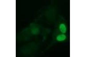 Image no. 2 for anti-Ubiquitin-Conjugating Enzyme E2S (UBE2S) antibody (ABIN1501646) (UBE2S Antikörper)