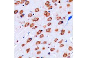Immunohistochemical analysis of Kir3. (KCNJ9 Antikörper  (Center))