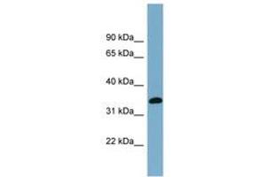 Image no. 1 for anti-Acyl-CoA Wax Alcohol Acyltransferase 1 (AWAT1) (AA 71-120) antibody (ABIN6743321) (AWAT1 Antikörper  (AA 71-120))