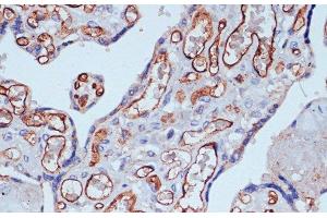 Immunohistochemistry of paraffin-embedded Human placenta using CD34 Polyclonal Antibody at dilution of 1:100 (40x lens). (CD34 Antikörper)