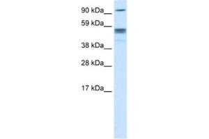 Western Blotting (WB) image for anti-Septin 4 (SEPT4) antibody (ABIN2463655) (Septin 4 Antikörper)