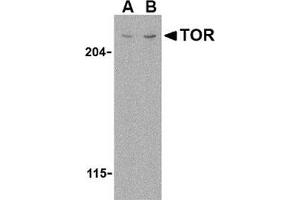 Western blot analysis of TOR in L1210 cell lysate with this product at (A) 1 and (B) 2 μg/ml. (MTOR Antikörper  (N-Term))