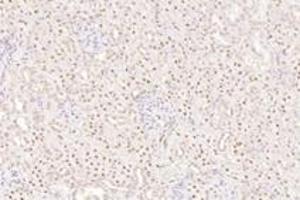 Immunohistochemistry analysis of paraffin-embedded rat kidney using,TORC1 (ABIN7073590) at dilution of 1: 800