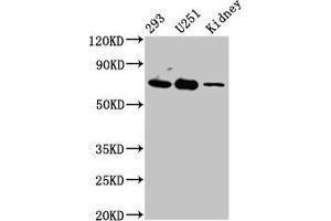 Western Blot Positive WB detected in: 293 whole cell lysate, U251 whole cell lysate, Rat kidney tissue All lanes: EOMES antibody at 4. (EOMES Antikörper  (AA 562-676))