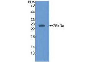 Western blot analysis of recombinant Human EBI3. (EBI3 Antikörper)