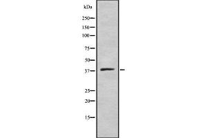 Western blot analysis of ELAV2/4 using COLO205 whole cell lysates (ELAV2/4 Antikörper)