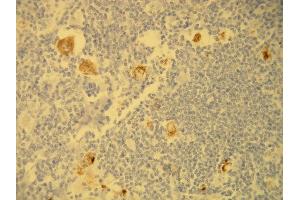 anti-Epstein-Barr Virus Latent Membrane Protein 1 (EBV LMP1) (AA 369-384), (C-Term) antibody