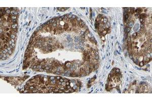ABIN6273576 at 1/100 staining Human prostate tissue by IHC-P.