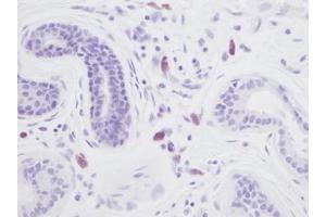 Image no. 1 for anti-Interleukin 8 (IL8) antibody (ABIN465357) (IL-8 Antikörper)