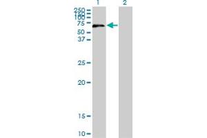 Western Blot analysis of UPF3A expression in transfected 293T cell line by UPF3A monoclonal antibody (M06), clone 2E2.