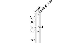 Western blot analysis of lysates from human heart and human skeletal muscle tissue lysate (from left to right), using DIO2 Antibody (Center) (ABIN652664 and ABIN2842445). (DIO2 Antikörper  (AA 165-191))