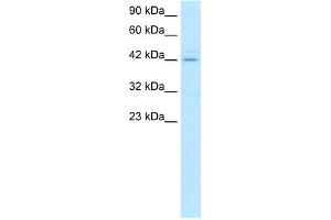 WB Suggested Anti-HOXA10 Antibody Titration:  0. (HOXA10 Antikörper  (N-Term))