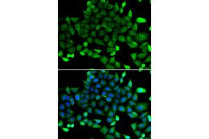 Immunofluorescence analysis of A549 cells using COMMD1 antibody (ABIN5974300). (COMMD1 Antikörper)