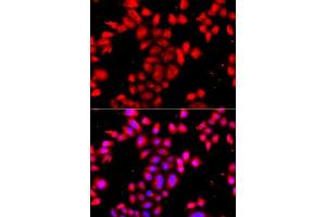 Immunofluorescence analysis of A549 cells using OSGEPL1 antibody. (OSGEPL1 Antikörper  (AA 1-270))