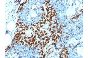 Formalin-fixed, paraffin-embedded human Lymph Node stained with CD163 Mouse Monoclonal Antibody (M130/2164). (CD163 Antikörper  (AA 43-196))