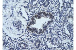 Rabbit Anti-RCOR1 Antibody       Paraffin Embedded Tissue:  Human bronchiole epithelium   Cellular Data:  Epithelial cells of renal tubule  Antibody Concentration:   4. (CoREST Antikörper  (Middle Region))