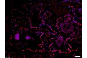 Paraformaldehyde-fixed, paraffin embedded human prostate tissue, Antigen retrieval by boiling in sodium citrate buffer(pH6) for 15min, Block endogenous peroxidase by 3% hydrogen peroxide for 30 minutes, Blocking buffer (normal goat serum) at 37°C for 20min, Antibody incubation with Rabbit Anti-DMA/Dmrt1a Polyclonal Antibody, Unconjugated  at 1:500 overnight at 4°C, followed by a conjugated secondary and DAB staining (DMO/Dmrt1a (AA 51-100) Antikörper)