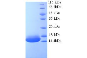 SDS-PAGE (SDS) image for Cyclin J-Like (CCNJL) (AA 315-435), (partial) protein (His tag) (ABIN5713328)