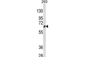Western Blotting (WB) image for anti-Cytochrome P450, Family 3, Subfamily A, Polypeptide 5 (CYP3A5) antibody (ABIN3003498) (CYP3A5 Antikörper)