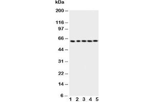 Western blot testing of p63 antbody; Lane 1: HeLa;  2: SMMC-7721;  3: COLO320;  4: A549;  5: SGC cell lysate (TCP1 alpha/CCTA Antikörper  (AA 82-98))