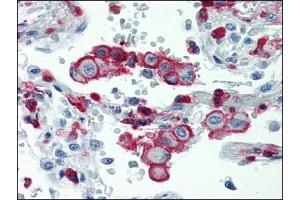 Immunohistochemistry (IHC) image for anti-Integrin beta 2 (ITGB2) antibody (ABIN614281) (Integrin beta 2 Antikörper)