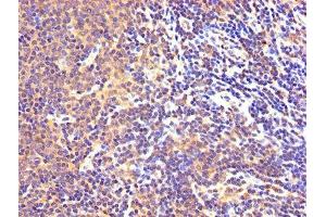 IHC image of ABIN7143989 diluted at 1:300 and staining in paraffin-embedded human lymph node tissue performed on a Leica BondTM system. (Monoamine Oxidase B Antikörper  (AA 2-489))